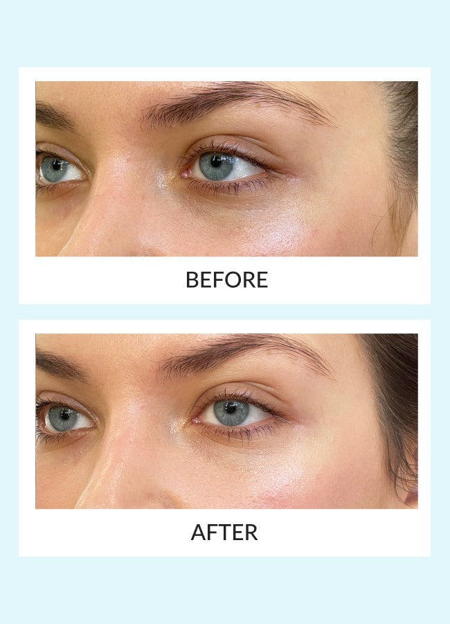 Talika Reusable Eye Therapy Patches Solo