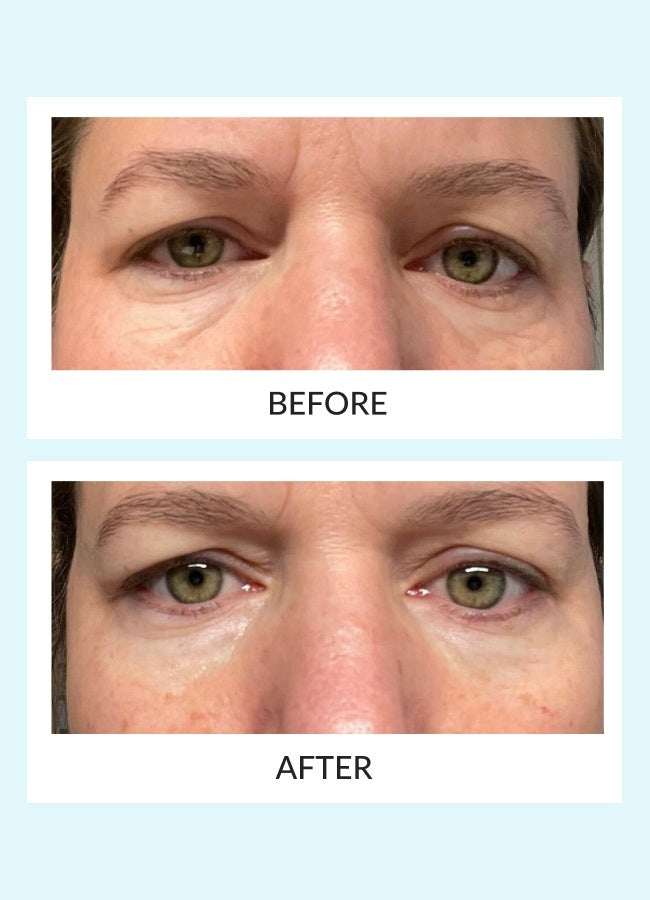 Talika Reusable Eye Therapy Patches Solo