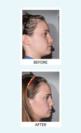 Hair Force Phyto-Serum