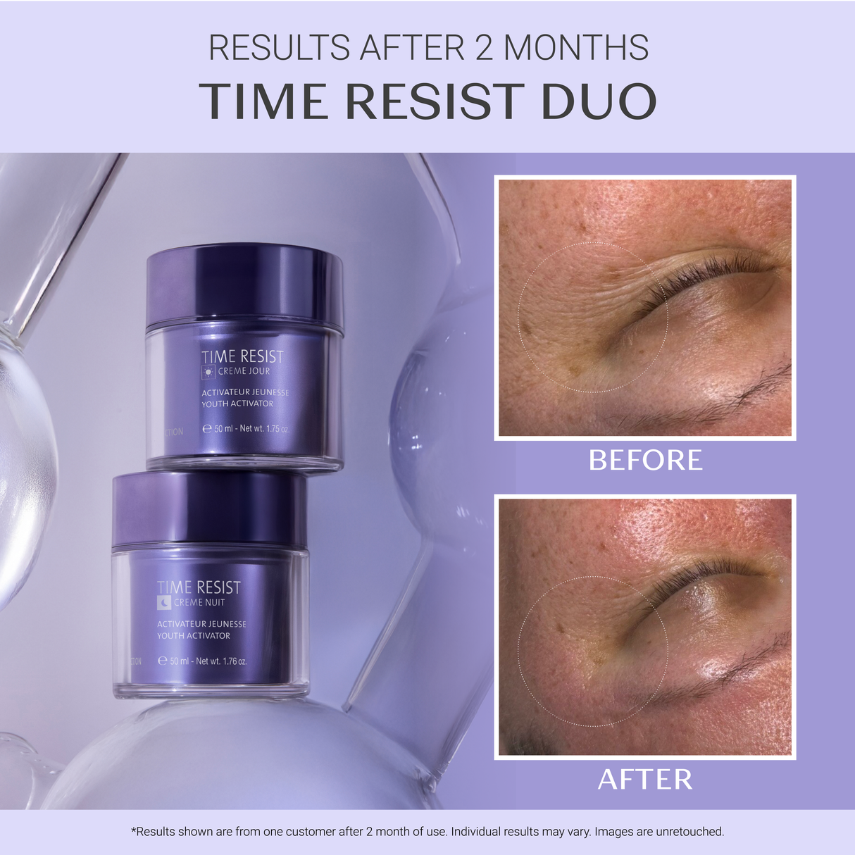Time Resist Duo