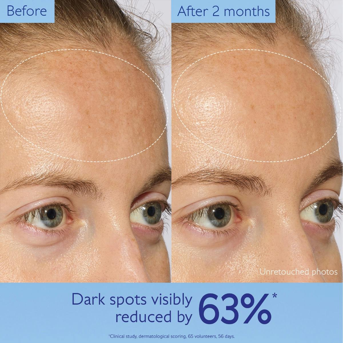 Caudalie Vinoperfect Dark Spot Serum Vitamin C Alternative