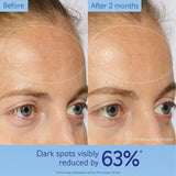 Caudalie Vinoperfect Dark Spot Serum Vitamin C Alternative