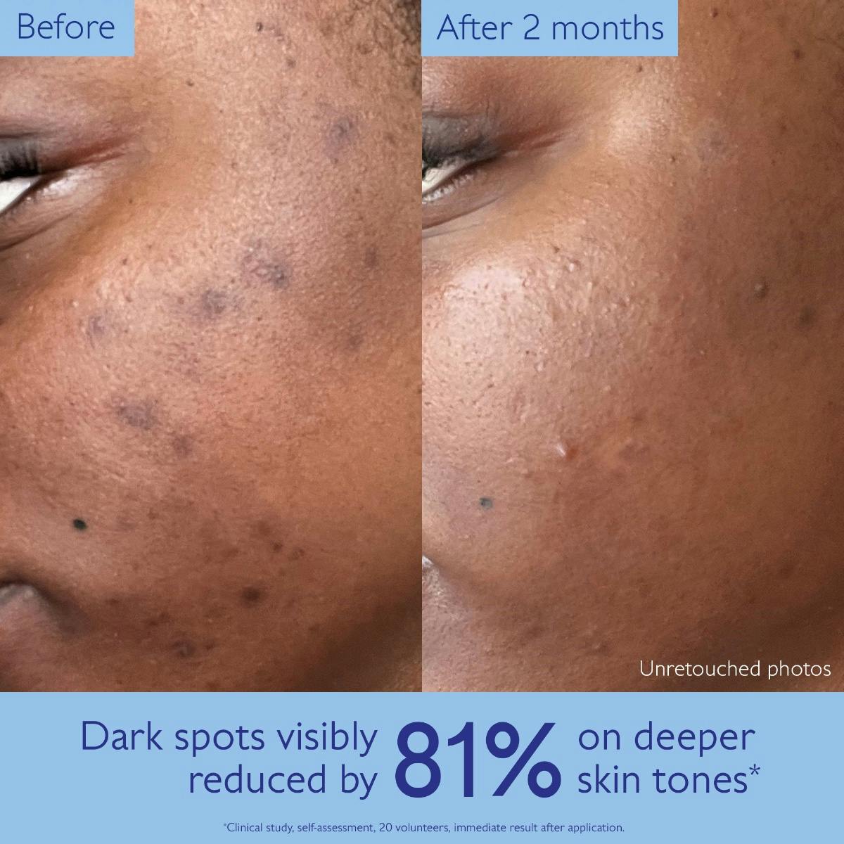 Caudalie Vinoperfect Dark Spot Serum Vitamin C Alternative