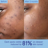 Caudalie Vinoperfect Dark Spot Serum Vitamin C Alternative